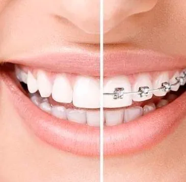 Bayres dental oeste