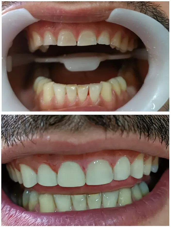 CED – Central de Estética Dental
