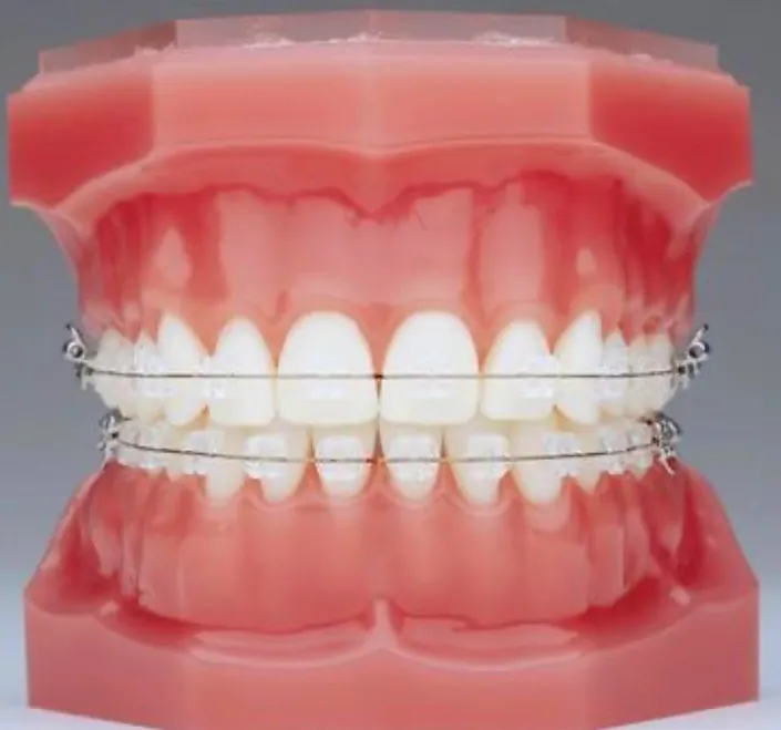 Code odontología y ortodoncia
