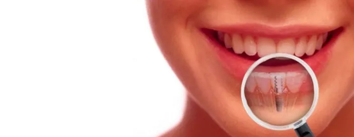 Dental Assistance Ⓡ