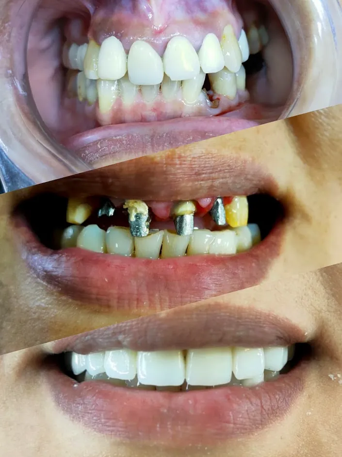Dental Max
