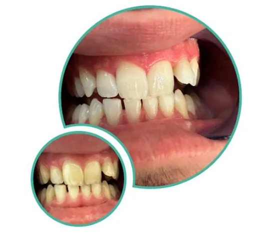 Dental Pleno (Monroe 5677)