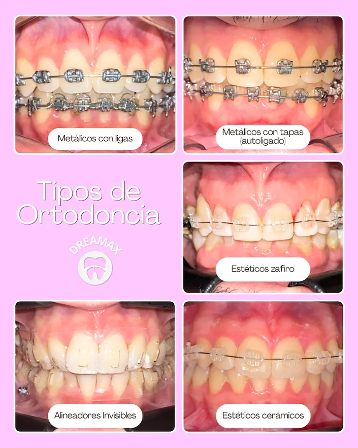Dreamax – Odontología Especializada