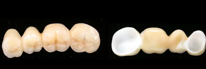 Estética Dental Kohen