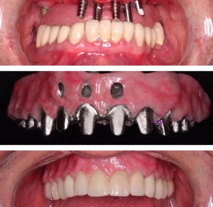Instituto Jaef® Implantes