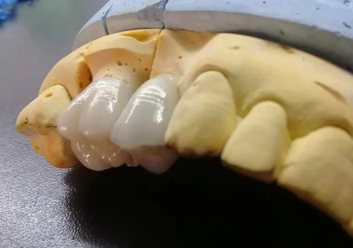 Laboratorio Dental Laforza