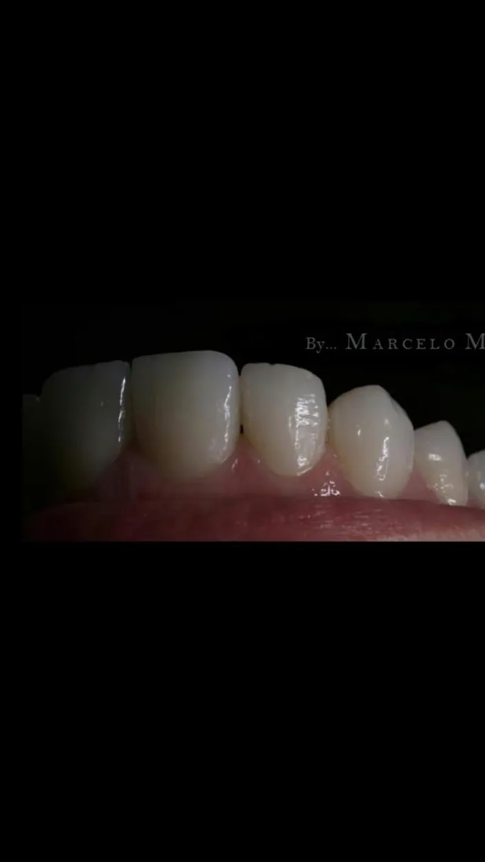 Malamudental