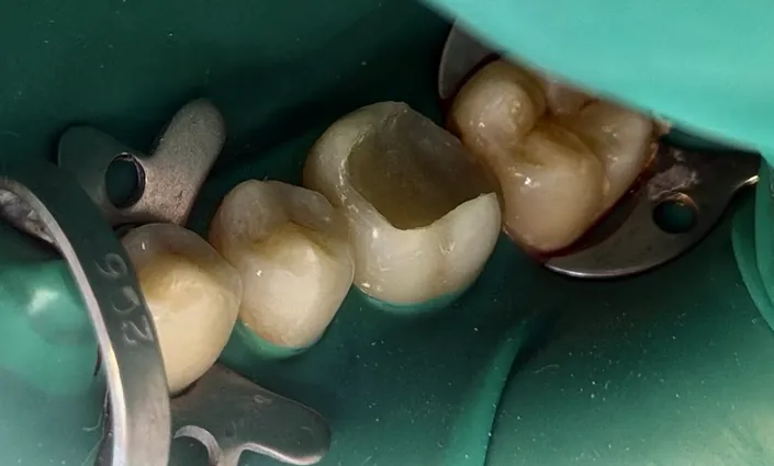 Odontologia bioDent