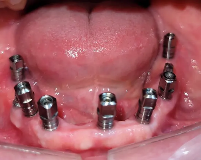 Odontología de alta complejidad Studio Cero