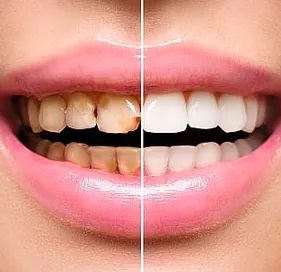 ODONTOLOGÍA INTEGRAL