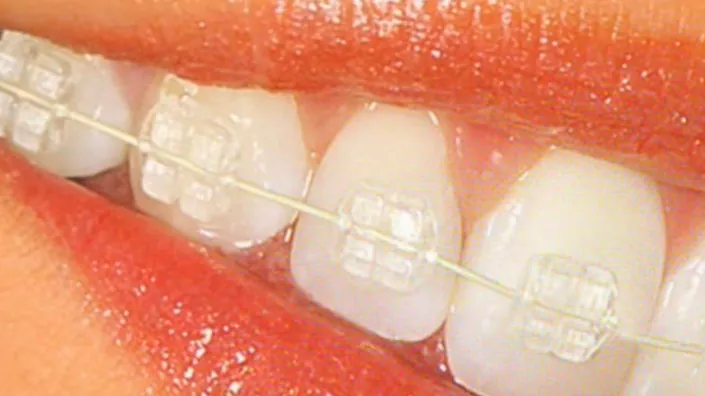 odontologiaheras