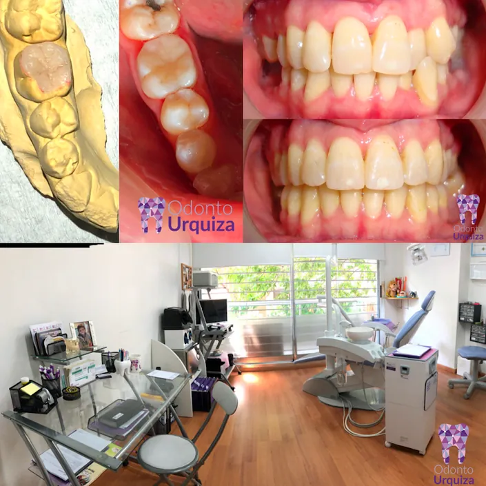 ODONTOURQUIZA / Odontología general/ Ortodoncia/ Coronas/ Limpiezas/ Extracciones