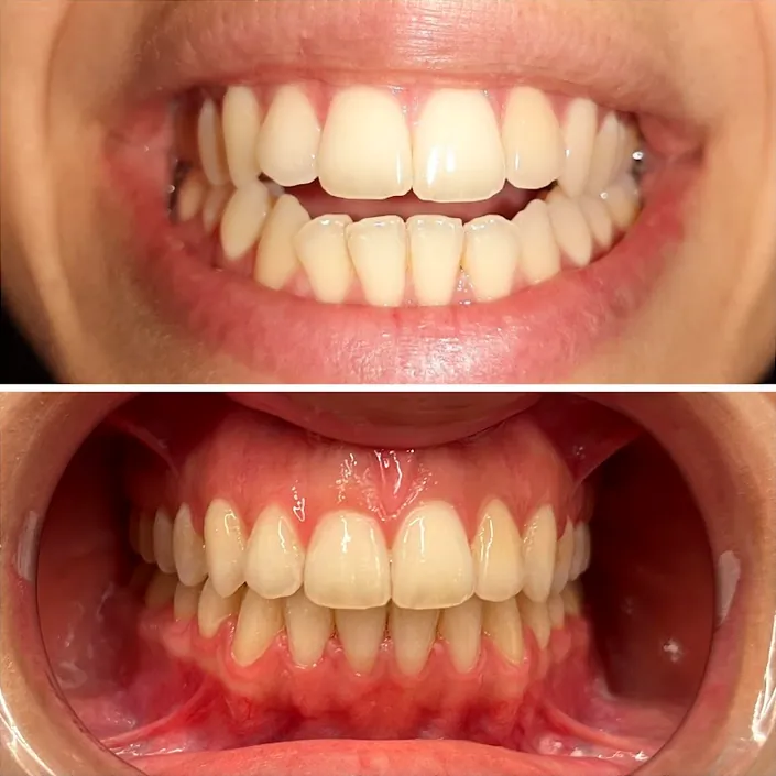 OVA Odontología | Dra. Araceli Van Opstal